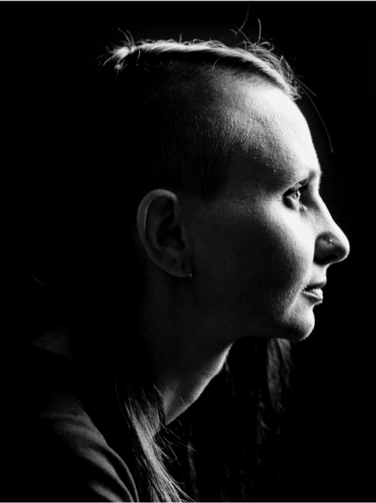 Black and white image of an actor portrayal of Trudhesa patient looking to right profile with partial shaved head